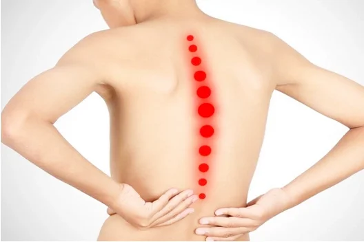 تأثیر ورزش بر جلوگیری از قوز و مشکلات ستون فقرات در کودکان